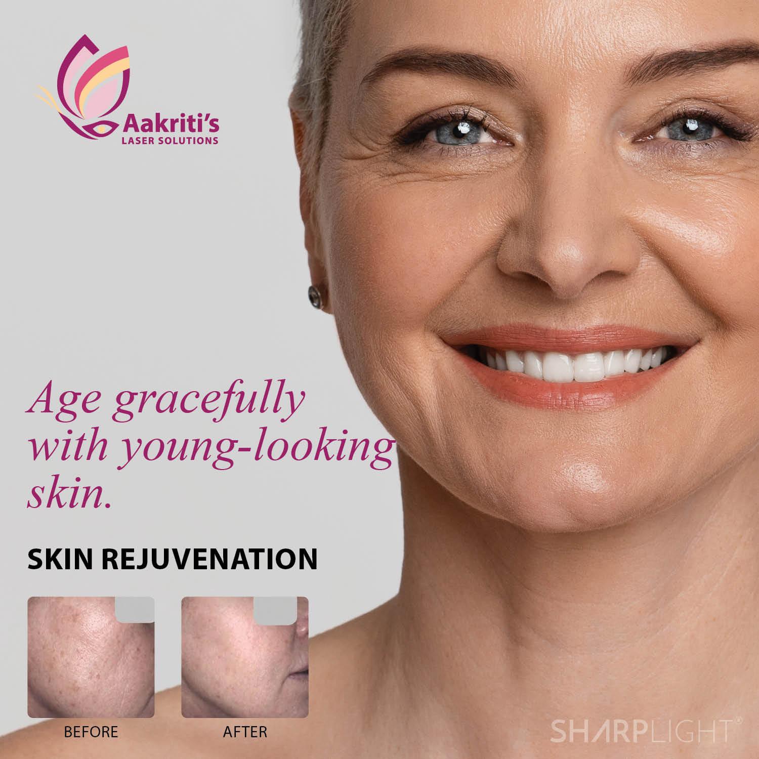 Facial Laser